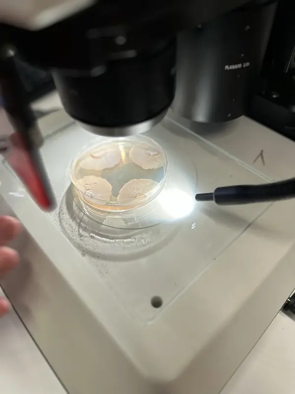 Almsjuka orsakas av svampar i släktet ophiostoma. De får almen att täppa till sina egna vattenkanaler, vilket leder till att den vissnar och dör. Bild: Daniel Stjärna/SLU