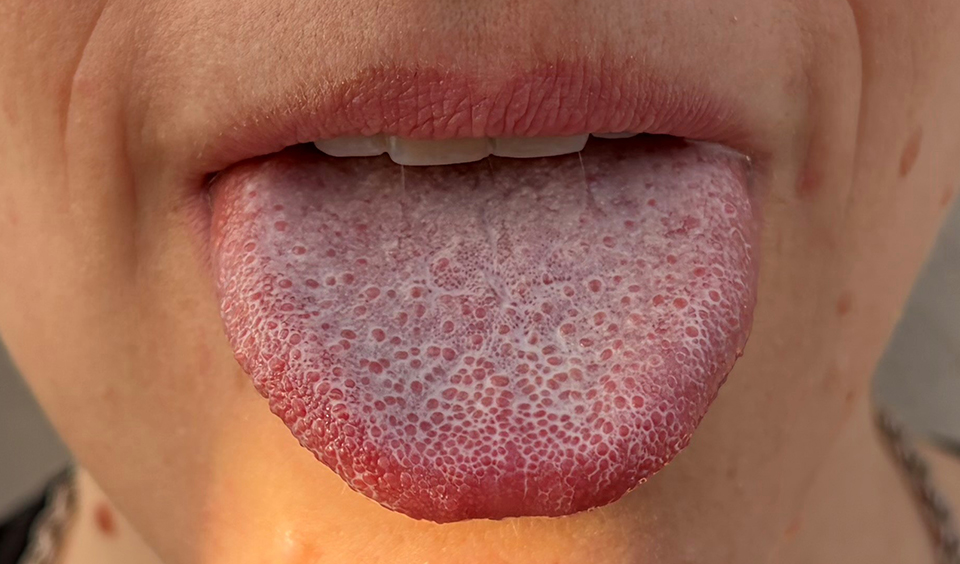 Foto på en mänsklig tunga.