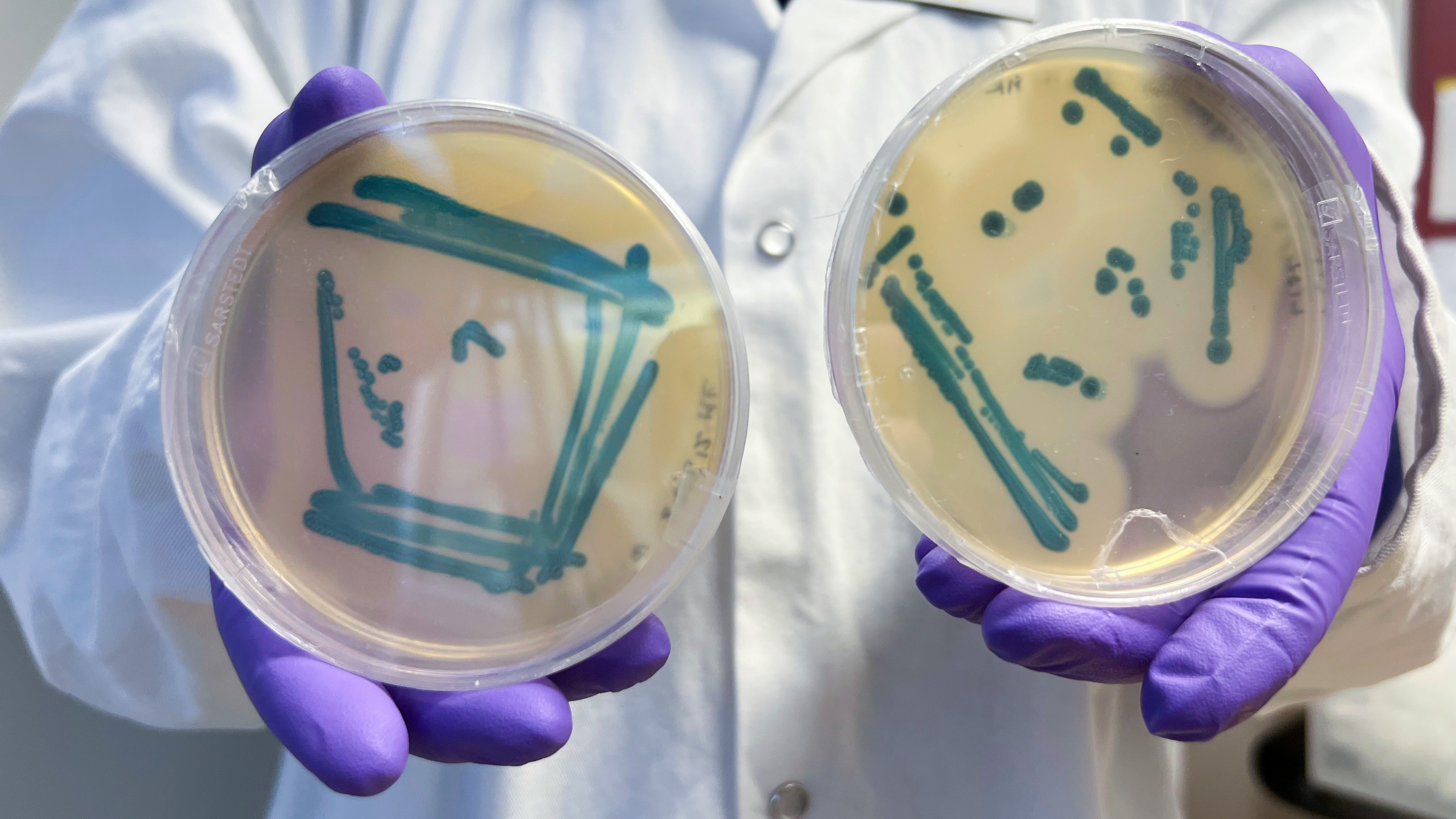 Petri dishes with growth is demonstrated