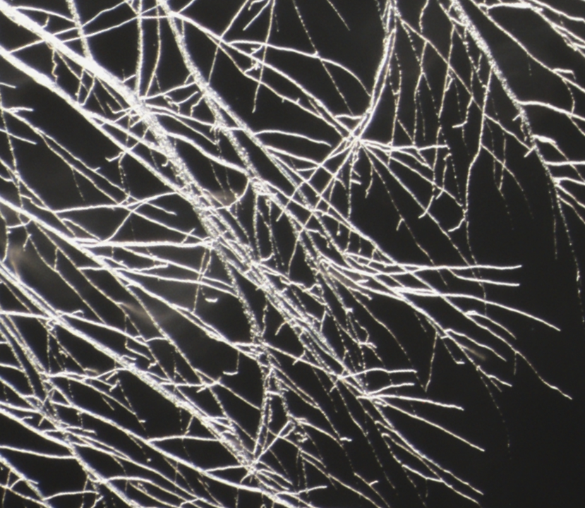 Mycelia of an aquatic fungus are seen as bright white, branching filaments on a black background