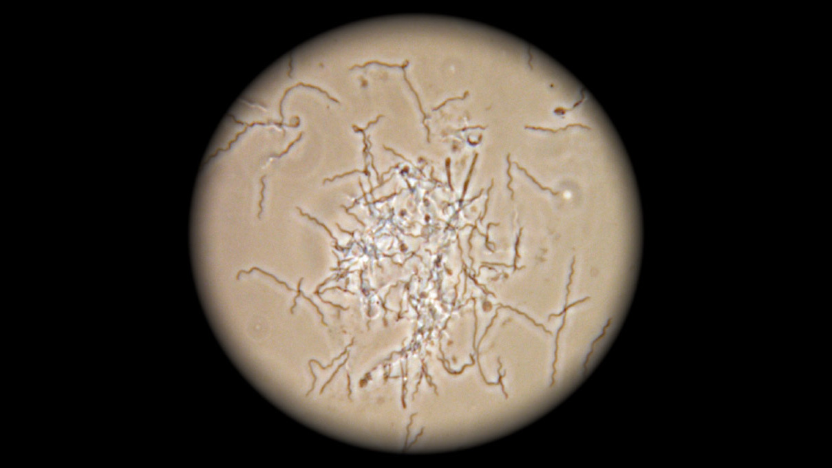Treponema bacteria.