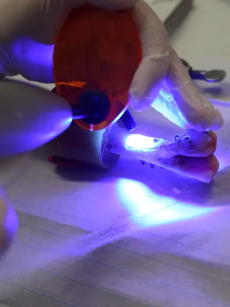 A bone with screws illuminated by a bright purple light. Photo.