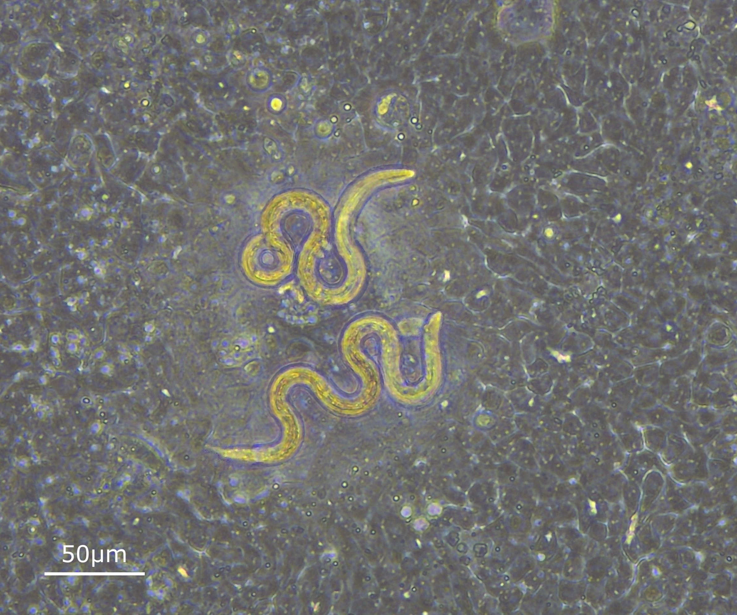 Light microscopy image of Parascaris univalens L3 on an organoid-derived monolayer