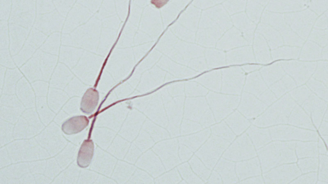 Sperm under a microscope.