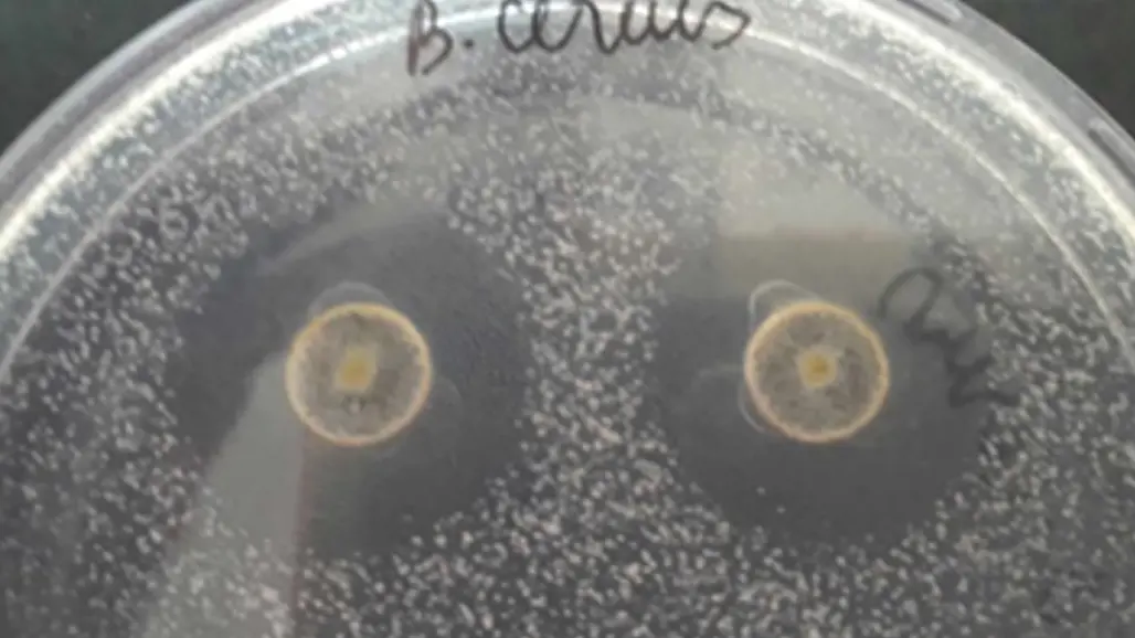 germ in a petri dish