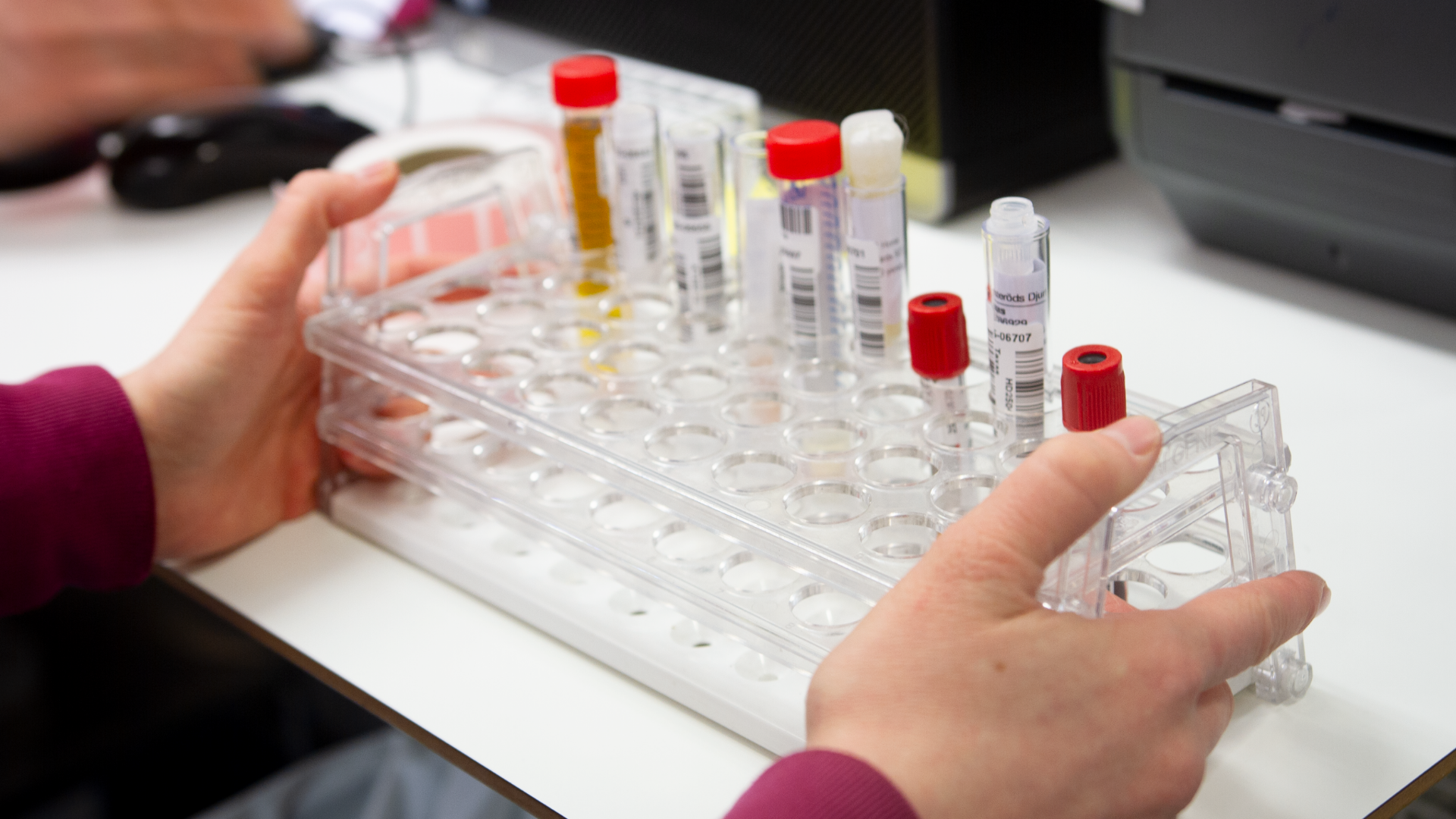 A transparent test tube rack with test tubes inside. The test tubes have red caps and white labels. Two arms are visible next to the test tube rack.