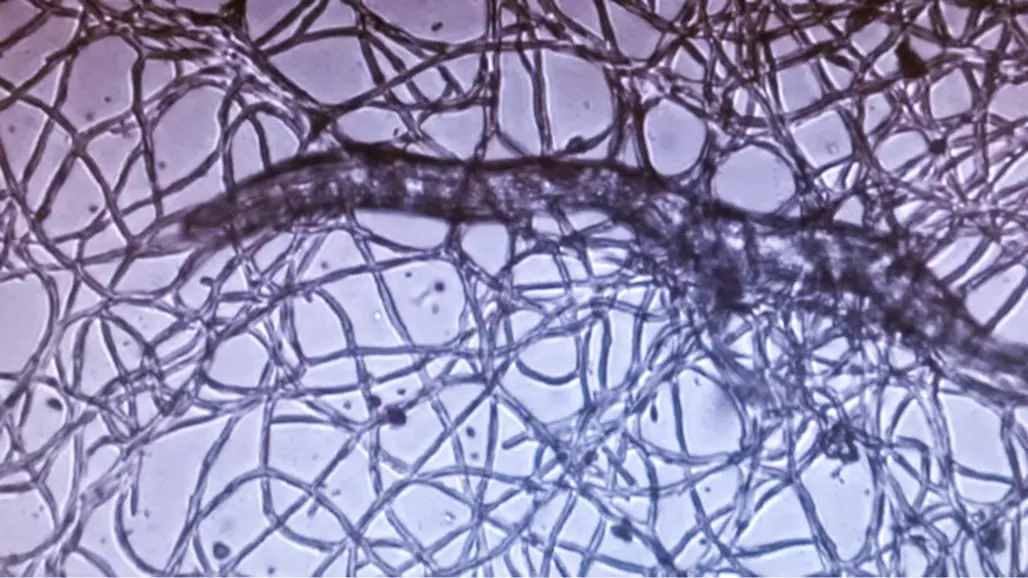 A worm with threads around it. Photo.