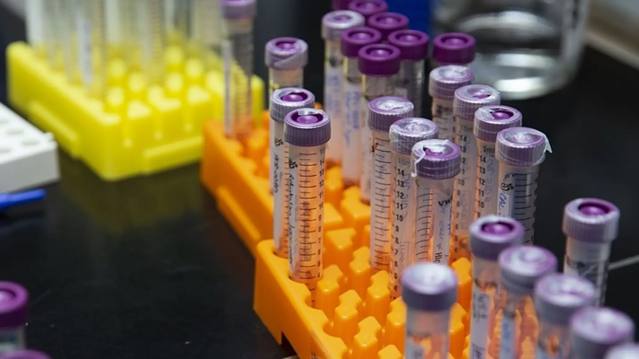 Foto av färgglada provtagningsrör i laboratorium.