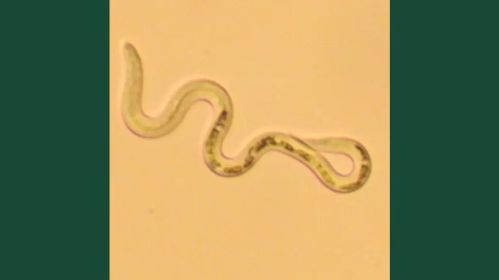 Photo of a roundworm.