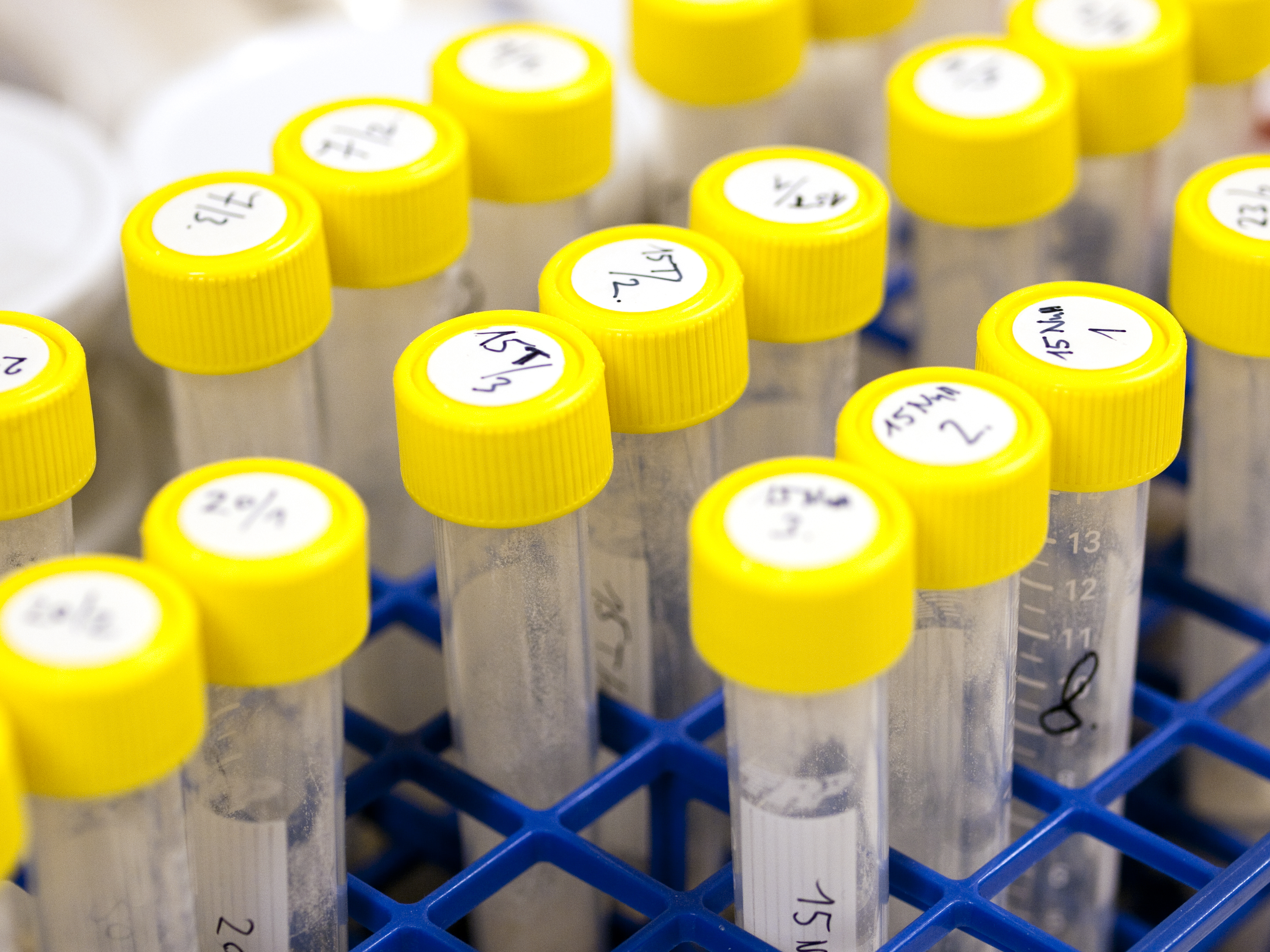 Picture of samples from a laboratory