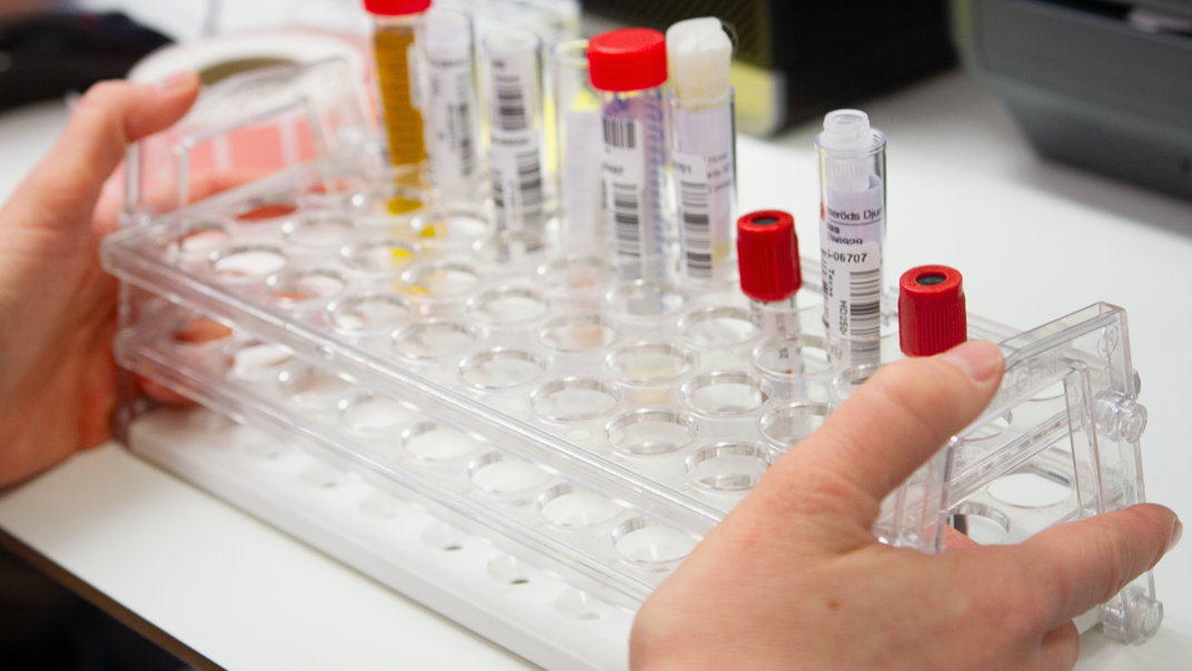 Hands holding a test tube holder.