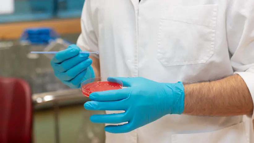 Photo of a Petri dish with bacterial culture in a laboratory.