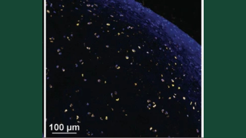 Foto av broskfragment från häst.