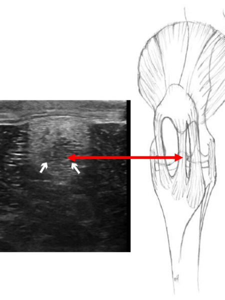 Röntgenbild och illustration av hästens knäskål. Kollage.