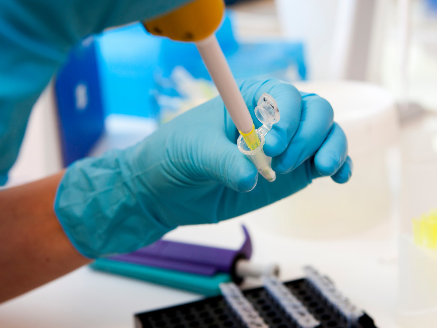 Picture of pipetting at lab.