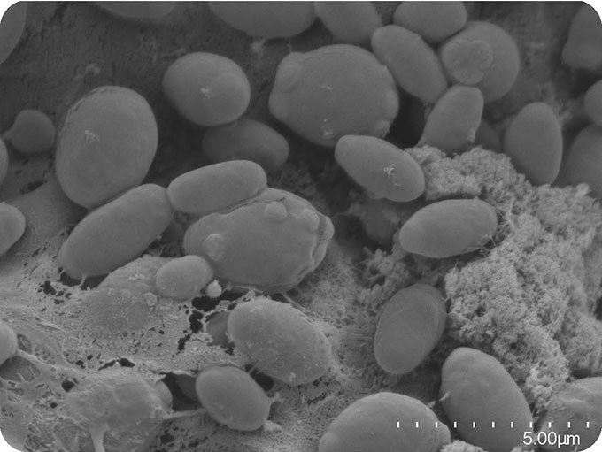 Electrone microscope image of yeast cells. Photo.