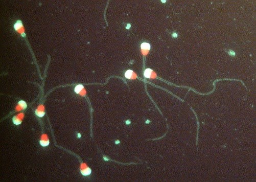 Mikroskopbild av spermier. Foto.