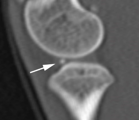 X-ray image of joint. photo