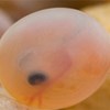 A fertilised trout egg. Photo.