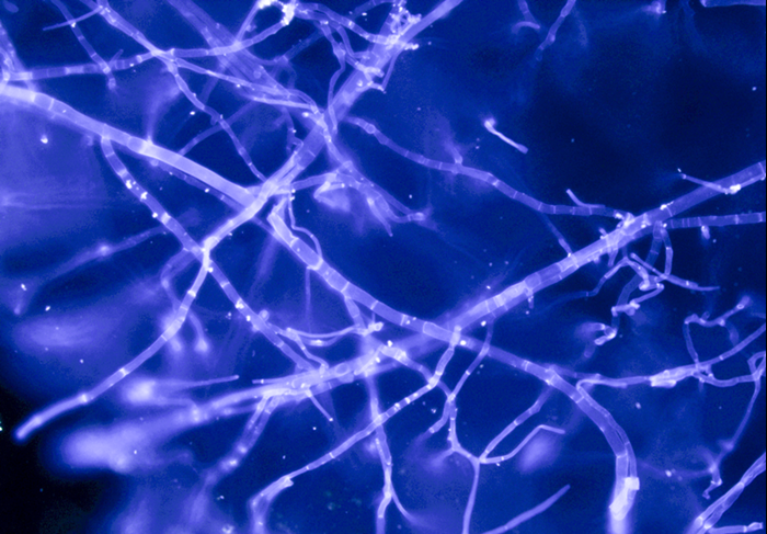 Blue fungal hyphae, microscope photo.