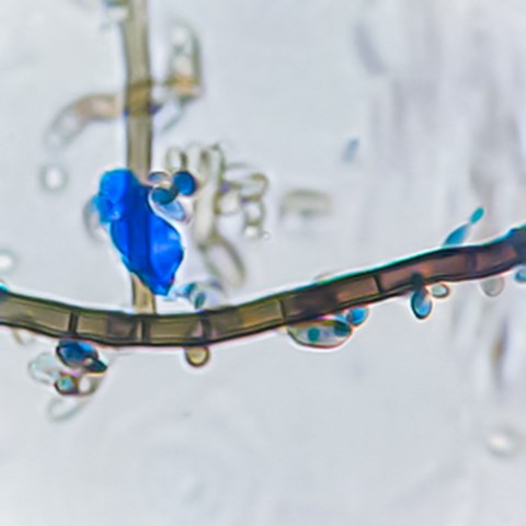 Black, oblong structures with blue, round structures on them. Microscope photo.