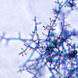 Microscope photo of fungal hyphae. Photo.