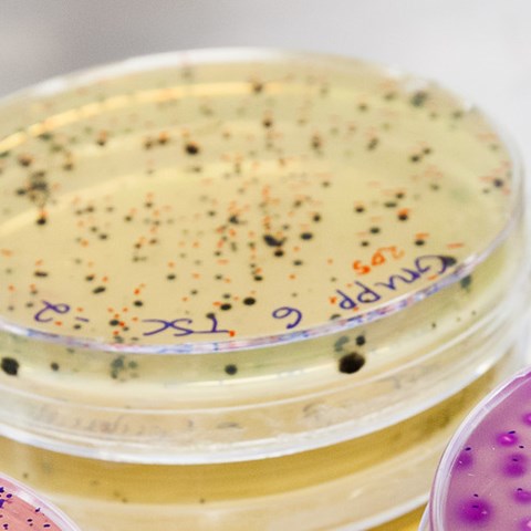 Petriskålar med bakterieodlingar. Foto.