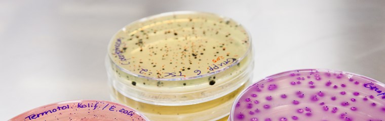 Petri dishes with bacterial culture. Photo.