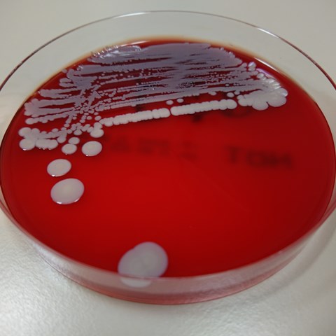Bacteriology blood