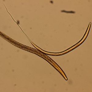 Blood worm in microscope, photo.