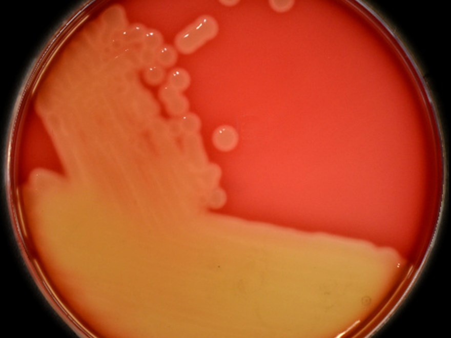 Streptococcus equi.
