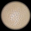 Treponema bacteria