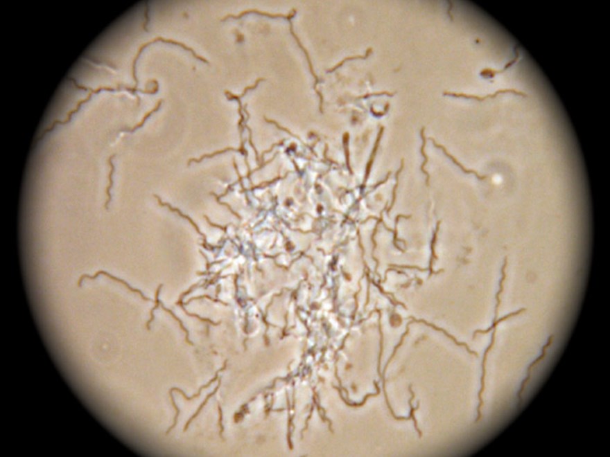 Treponema bacteria