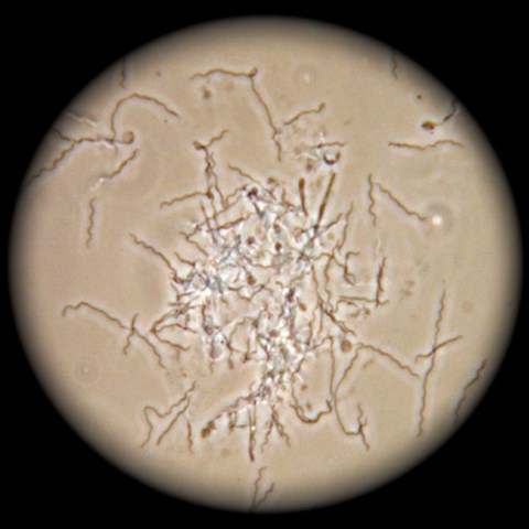 Treponema bacteria