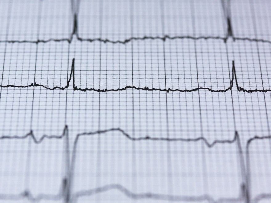 ecg-curve