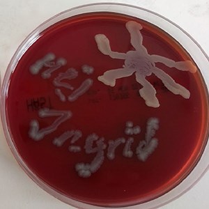 Plate with bacteria