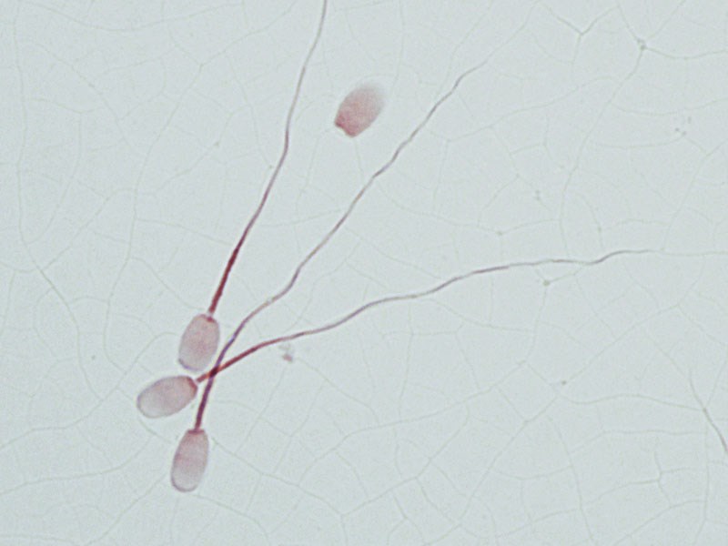 Sperm