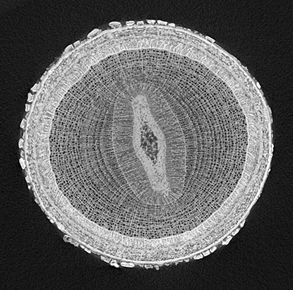 Ett svartvitt, mikroskopiskt snitt, foto.