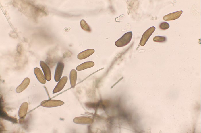 Oval figures. Microscopy photo.