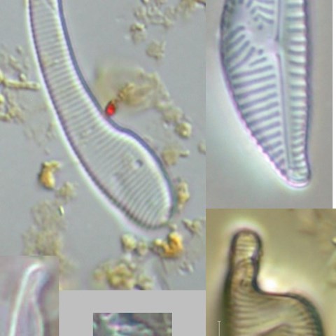 Deformed diatoms. Collage of microscope pictures.