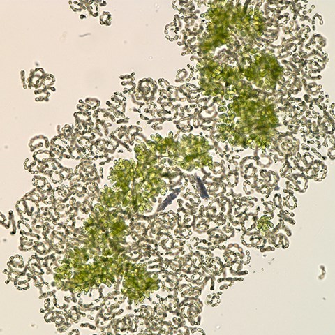 Cyanobacteria Dolichospermum sp.,  short corkscrews. Microscope image.