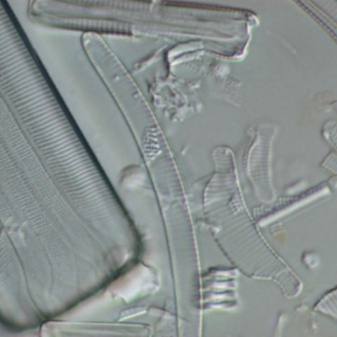 Flera kiselalger. Mikroskopbild.