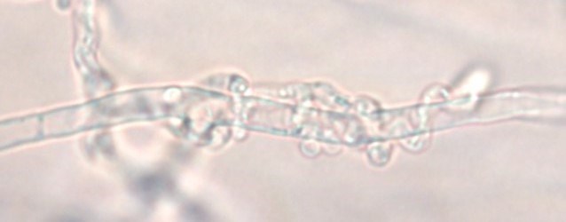 P. oligandrum