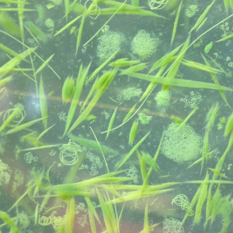 Cyano bacteria in micro scope. Photo.