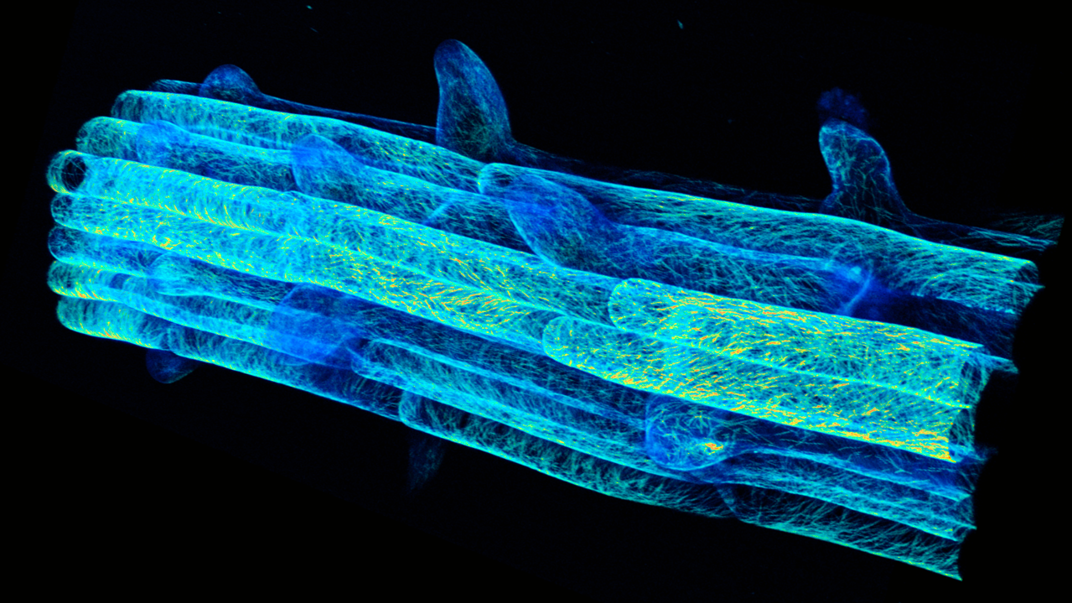 A blue and yellow coloured cylindrical part of a root build up by elongated cells with some side roots emerging